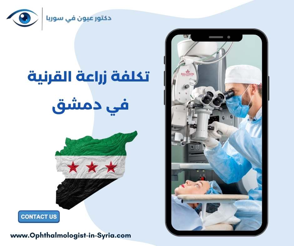 تكلفة زراعة القرنية في دمشق