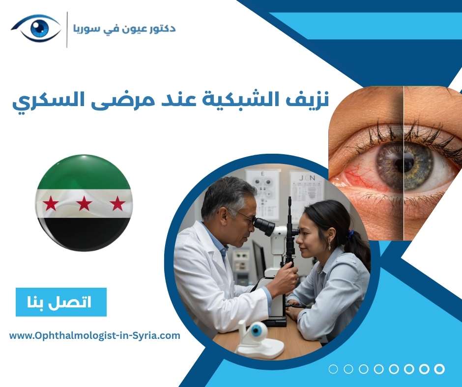 نزيف الشبكية عند مرضى السكري