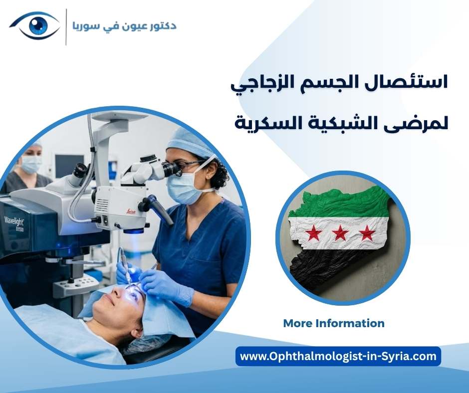 استئصال الجسم الزجاجي لمرضى الشبكية السكرية استئصال الجسم الزجاجي لمرضى الشبكية السكرية