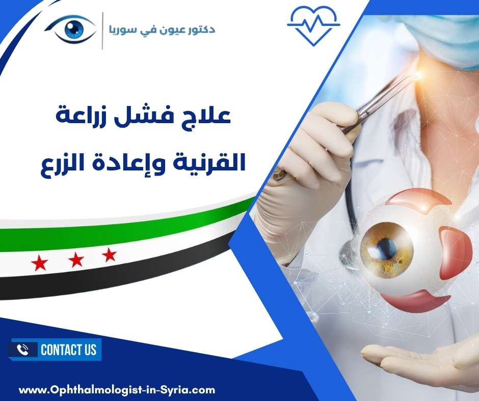 علاج فشل زراعة القرنية وإعادة الزرع