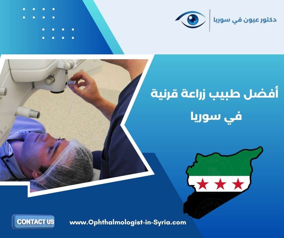 أفضل طبيب زراعة قرنية في سوريا 