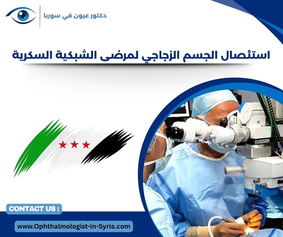 استئصال الجسم الزجاجي لمرضى الشبكية السكرية استئصال الجسم الزجاجي لمرضى الشبكية السكرية
