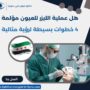 هل عملية الليزر للعيون مؤلمة