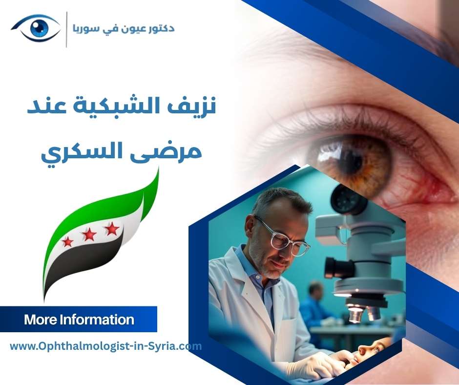 نزيف الشبكية عند مرضى السكري