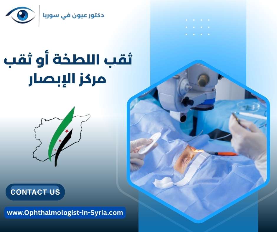 ثقب اللطخة أو ثقب مركز الإبصار
