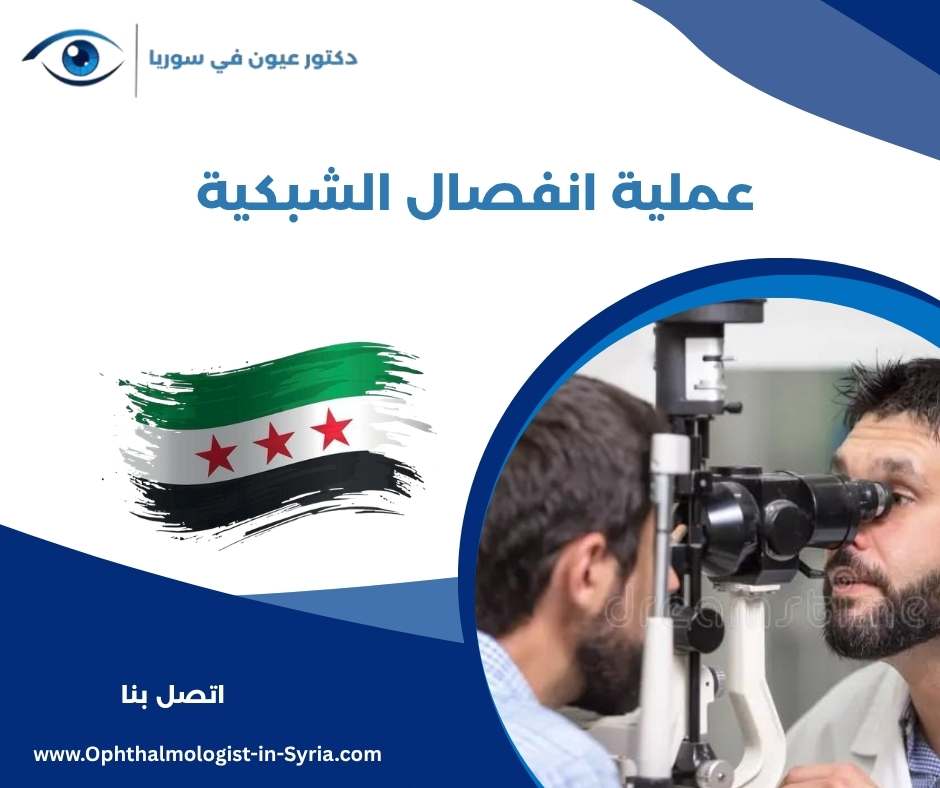 عملية انفصال الشبكية