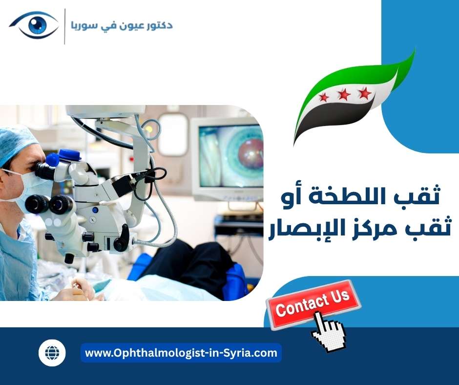 ثقب اللطخة أو ثقب مركز الإبصار