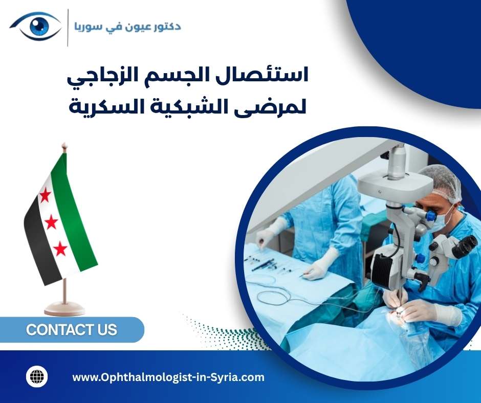 استئصال الجسم الزجاجي لمرضى الشبكية السكرية استئصال الجسم الزجاجي لمرضى الشبكية السكرية