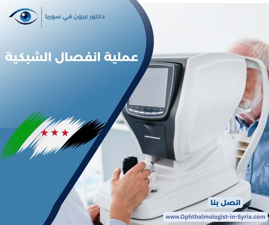 عملية انفصال الشبكية