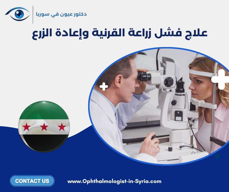 علاج فشل زراعة القرنية وإعادة الزرع