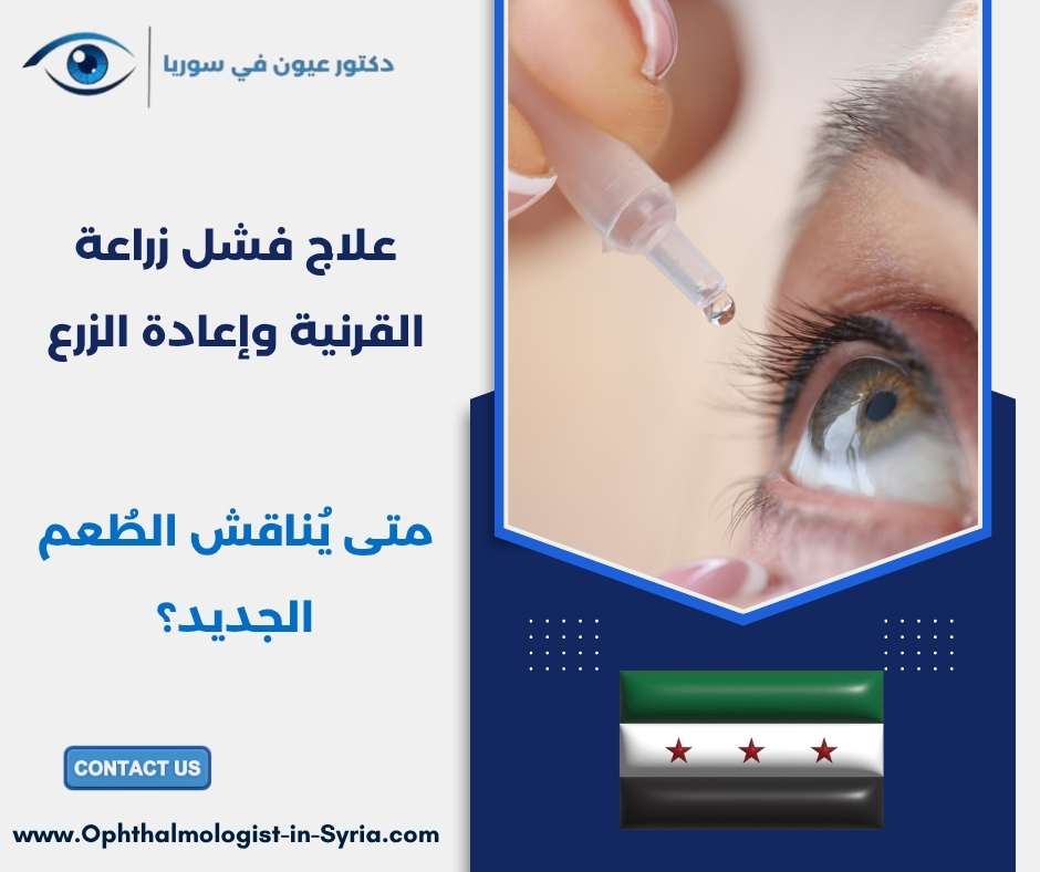 علاج فشل زراعة القرنية وإعادة الزرع