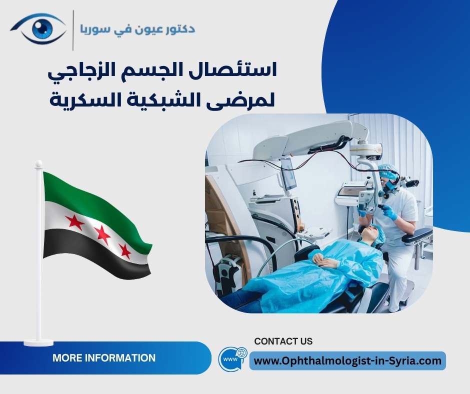 استئصال الجسم الزجاجي لمرضى الشبكية السكرية استئصال الجسم الزجاجي لمرضى الشبكية السكرية