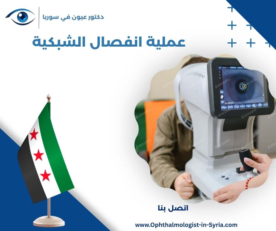 عملية انفصال الشبكية
