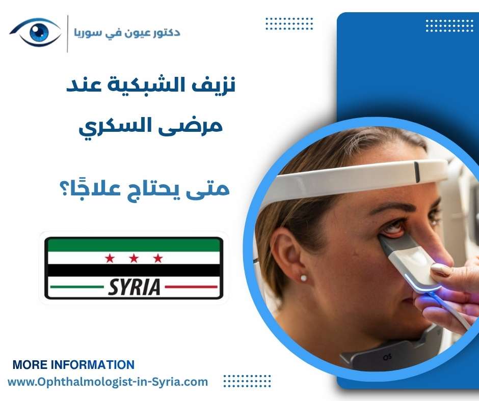 نزيف الشبكية عند مرضى السكري