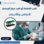 ثقب اللطخة أو ثقب مركز الإبصار