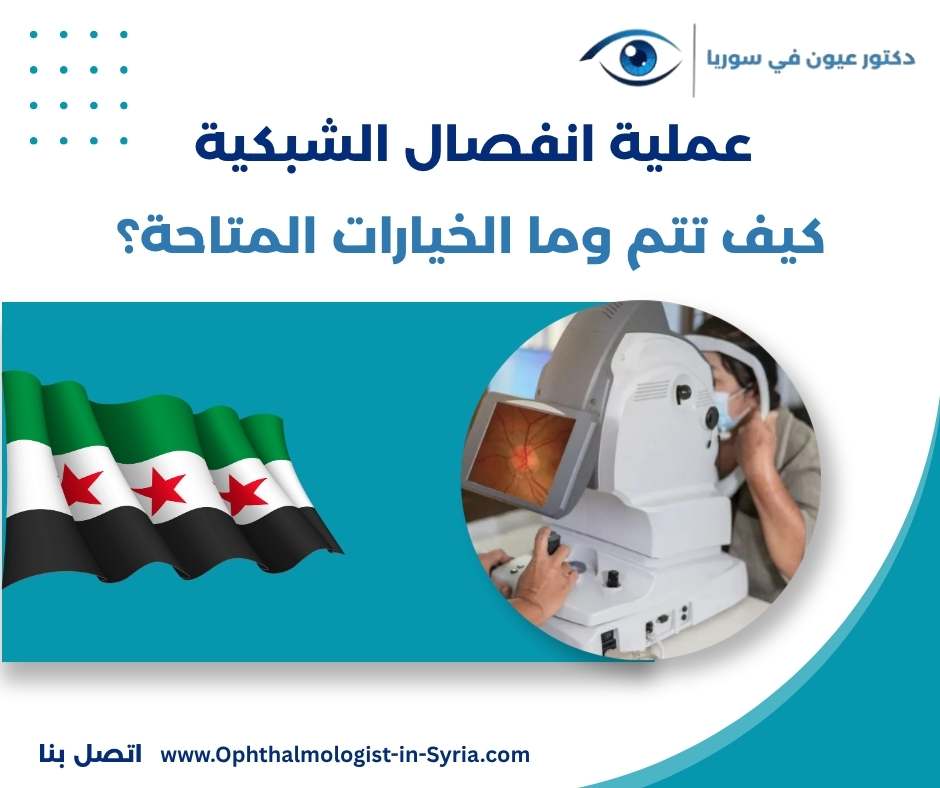 عملية انفصال الشبكية