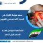 سعر عملية الليزك في المركز التخصصي للعيون