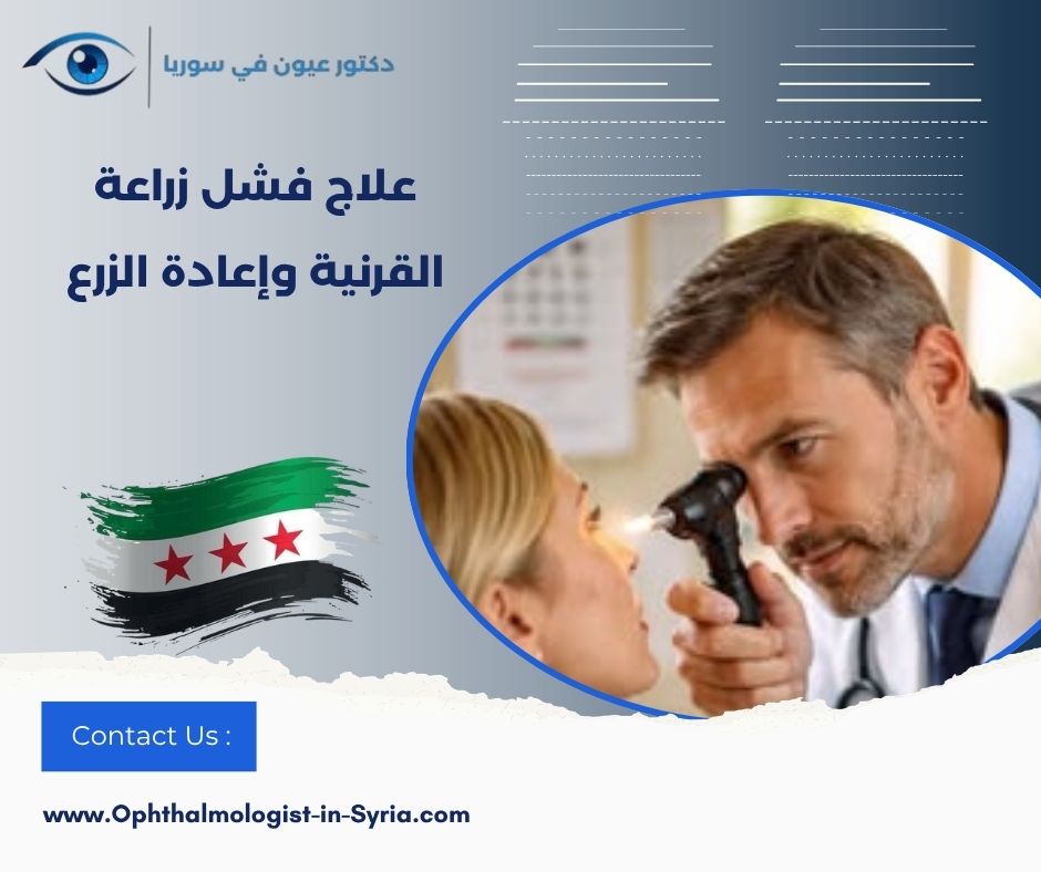 علاج فشل زراعة القرنية وإعادة الزرع